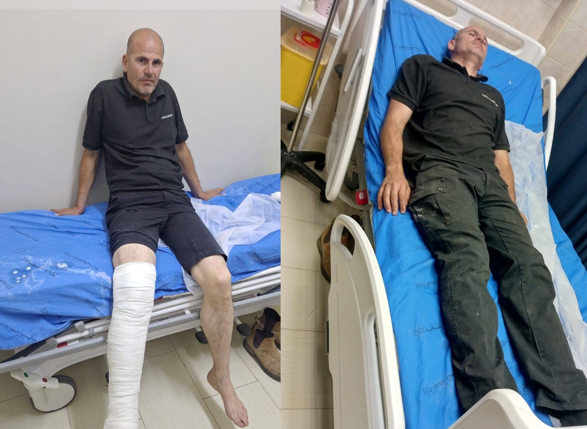 إصابة مواطن بكسر في الساق جراء اعتداء قوات الاحتلال عليه في ديربلوط
