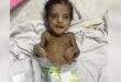 وفاة رضيعين جوعا جراء الحصار الإسرائيلي لغزة