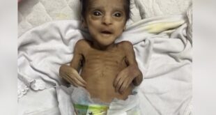وفاة رضيعين جوعا جراء الحصار الإسرائيلي لغزة
