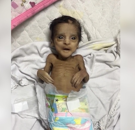 وفاة رضيعين جوعا جراء الحصار الإسرائيلي لغزة
