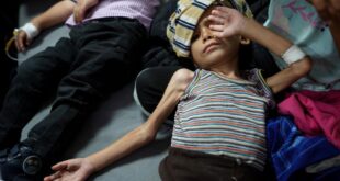 قطاع غزة : ارتفاع عدد الشهداء الأطفال نتيجة سوء التغذية إلى 66
