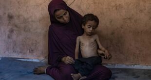 وفاة طفل بسبب المجاعة وسوء التغذية في قطاع غزة