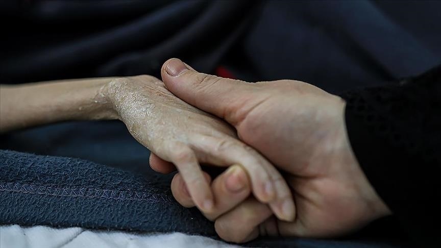 وفاة طفلة نتيجة سوء التغذية في غزة
