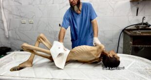 665 يوماً من حرب الإبادة والتجويع على قطاع غزة