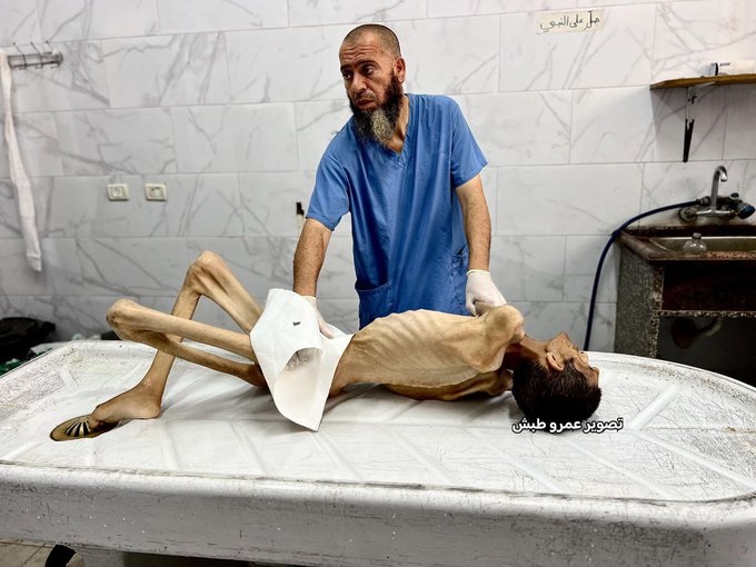 665 يوماً من حرب الإبادة والتجويع على قطاع غزة