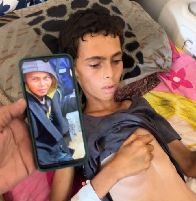 وفاة الفتى عاطف أبو خاطر بسبب المجاعة في غزة