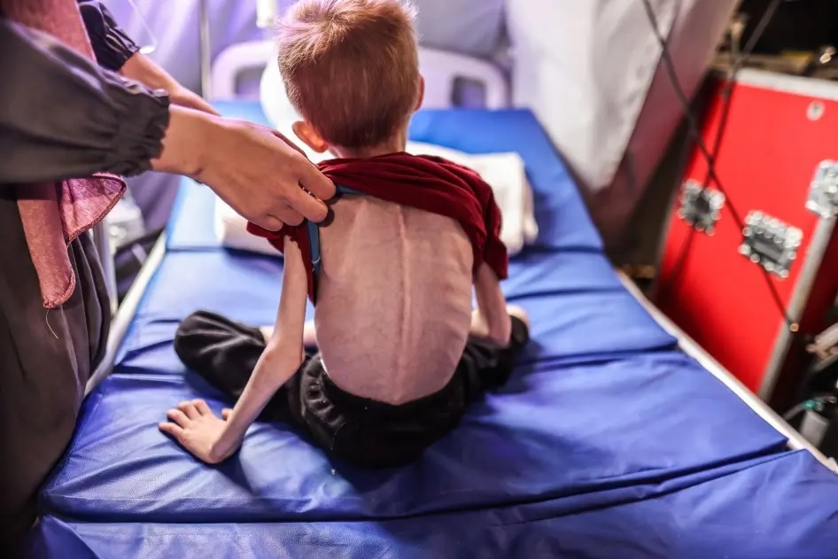 مقرر أممي : تجويع "إسرائيل" لغزة جريمة حرب