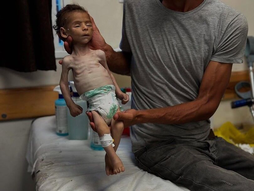 خلال 24 ساعة .. 5 وفيات نتيجة المجاعة في قطاع غزة