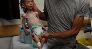 خلال 24 ساعة .. 5 وفيات نتيجة المجاعة في قطاع غزة