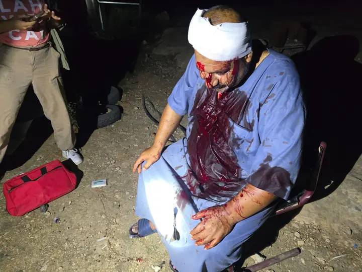  إصابة مواطن وزوجته جراء الاعتداء عليهم من قبل المستوطنين جنوب الخليل