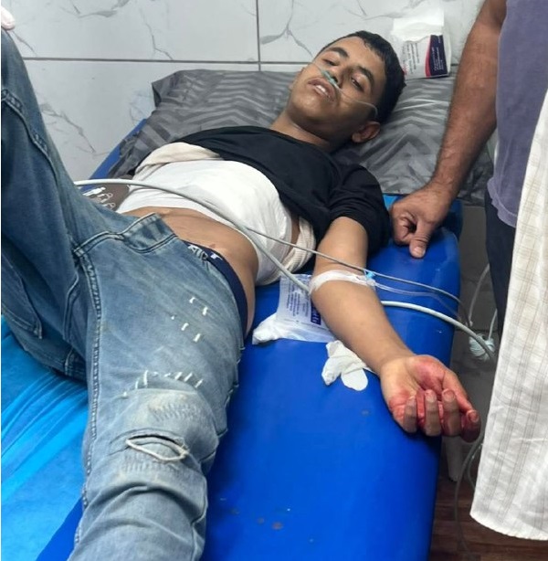 إصابة 3 مواطنين بالرصاص في هجوم للمستوطنين على المزرعة الشرقية شرقي رام الله
