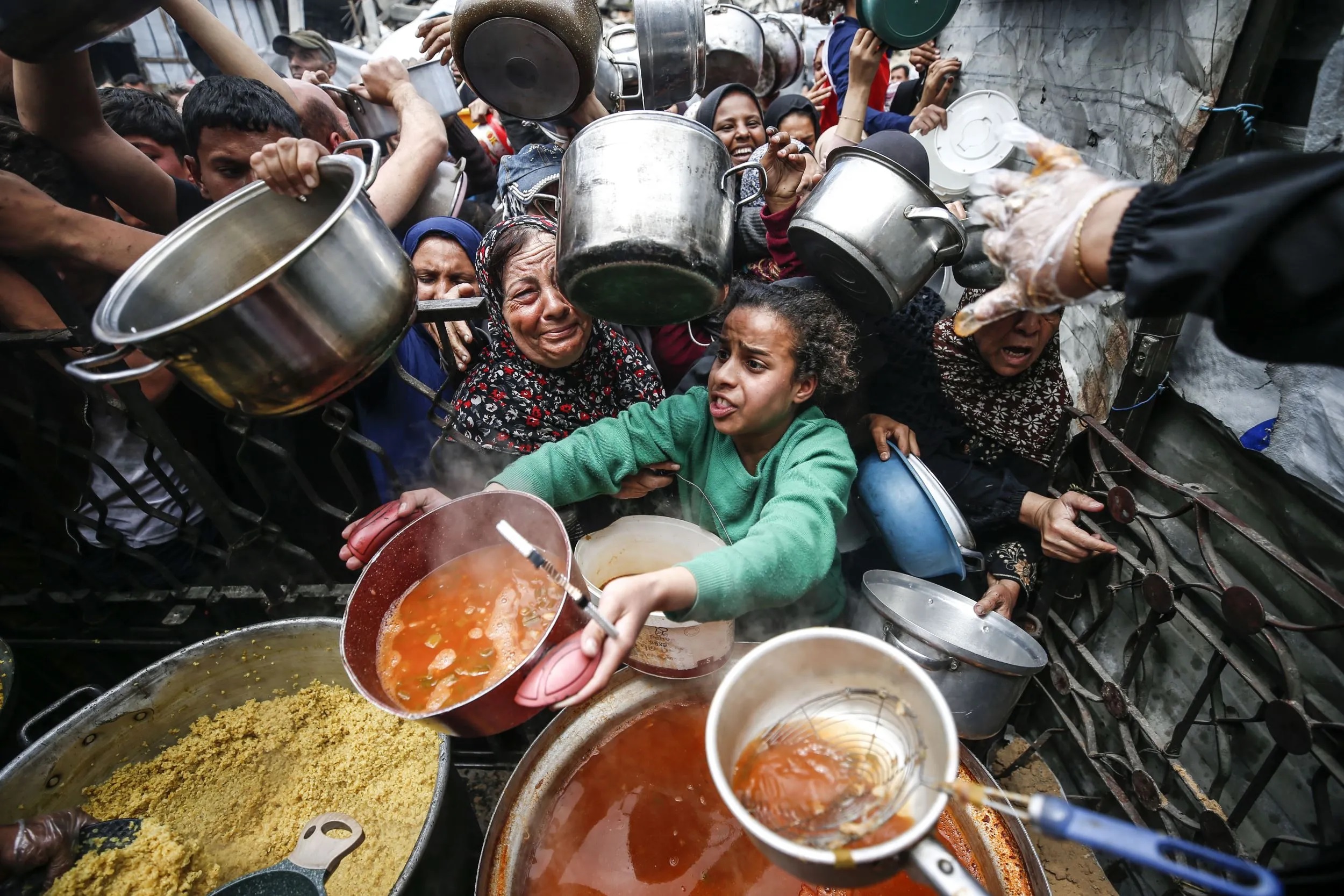 6 وفيات من بينها طفلان نتيجة المجاعة وسوء التغذية خلال الـ24 ساعة الماضية