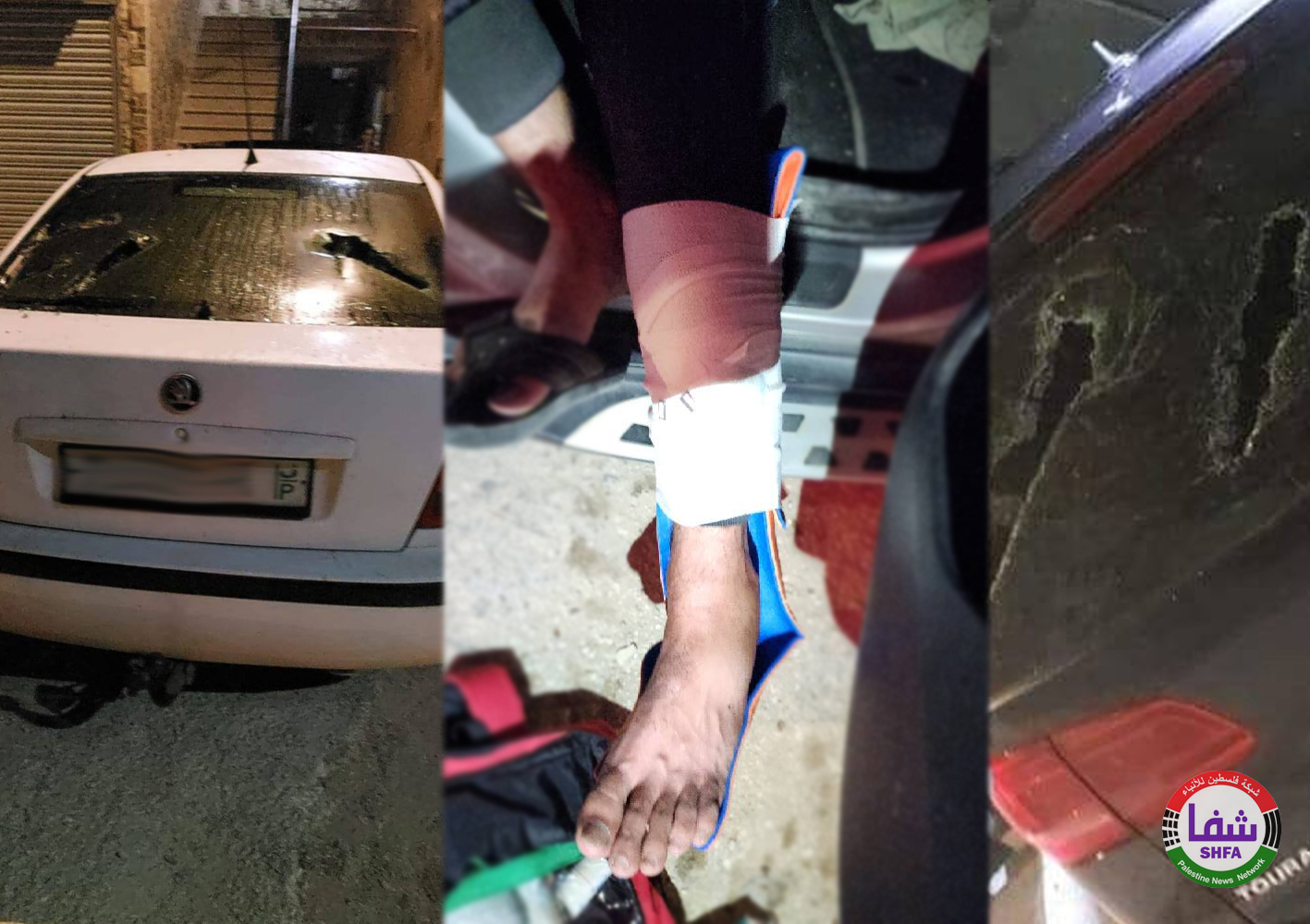 إصابة مواطن وتحطيم مركبات خلال هجوم لمستوطنين جنوب نابلس