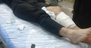 إصابات بالرصاص الحي خلال مواجهات مع قوات الاحتلال في طوباس