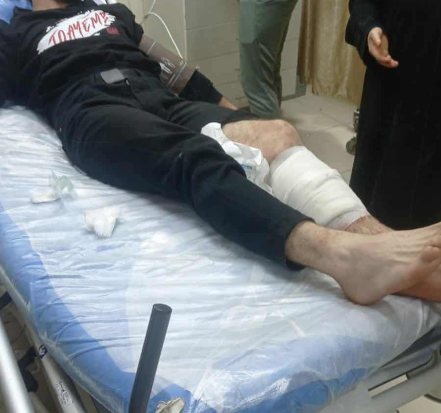 إصابات بالرصاص الحي خلال مواجهات مع قوات الاحتلال في طوباس