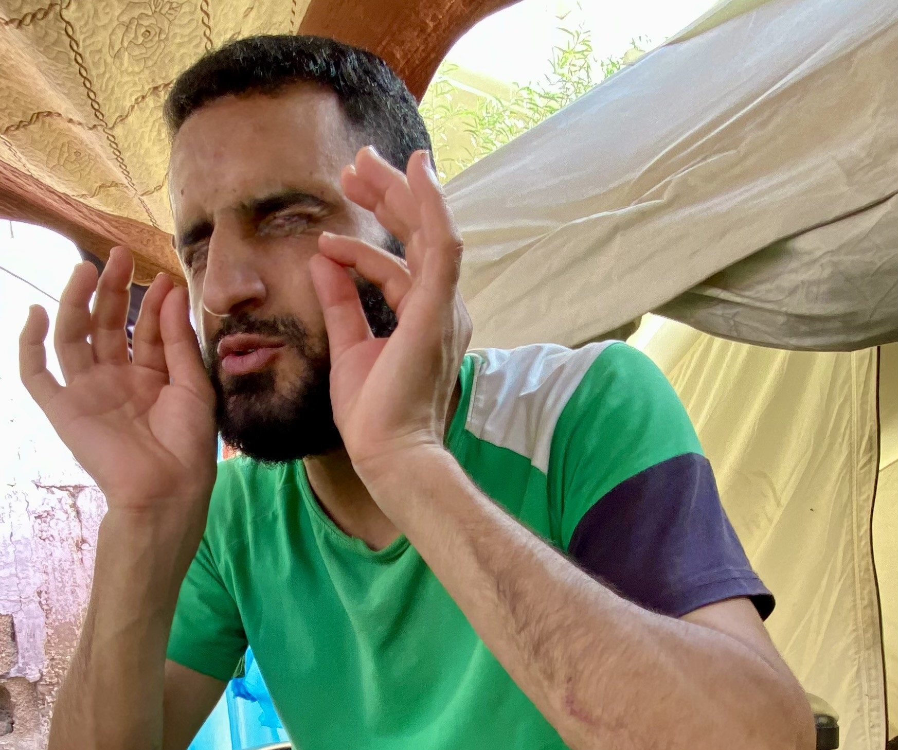 تعذيب الاحتلال يسلب أسيرا بصره ويتركه يحن إلى ملامح والديه