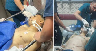 إصابة الشاب جميل حنني برصاص الاحتلال في بيت فوريك شرق نابلس