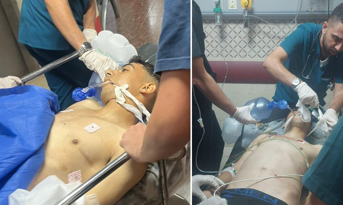 إصابة الشاب جميل حنني برصاص الاحتلال في بيت فوريك شرق نابلس