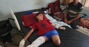 صحة غزة : نفتقد لأجهزة طبية هامة ونضطر للبتر لعدم توفر الإمكانات