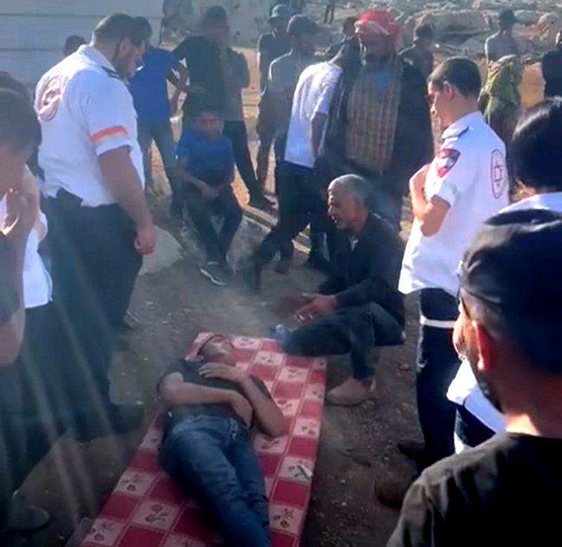 إصابة 7 مواطنين في هجوم للمستوطنين على تجمع "المعازي" البدوي قرب جبع شمال القدس