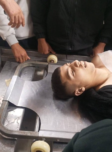 استشهاد الفتى حسن شركسي وإصابة اخر برصاص الاحتلال في مخيم عسكر شرق نابلس