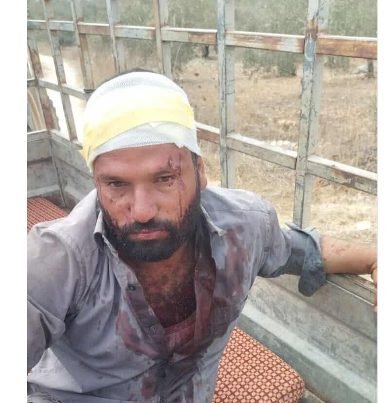 مستوطنون يشنون هجومًا عنيفًا في قرية بيت ليد شرق طولكرم