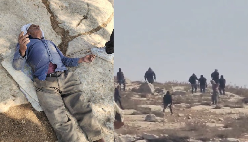 إصابة مواطن مسن جراء اعتداء مستوطنين على مسافر يطا جنوب الخليل