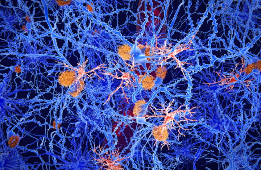 علاج مبتكر للصرع يعيد الذاكرة ويقي من النوبات