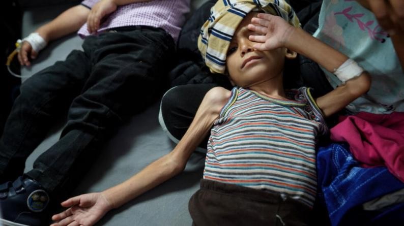 الأمم المتحدة: عدد حالات سوء التغذية الحاد بغزة ارتفع إلى 95 ألفا