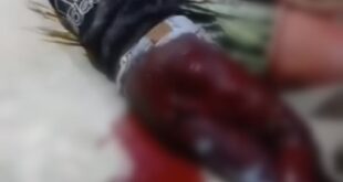 إصابة شاب وطفل برصاص الاحتلال في الخليل والعيزرية