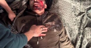 شهيدان شقيقان وإصابات بينها خطيرة برصاص الاحتلال بمدينة غزة