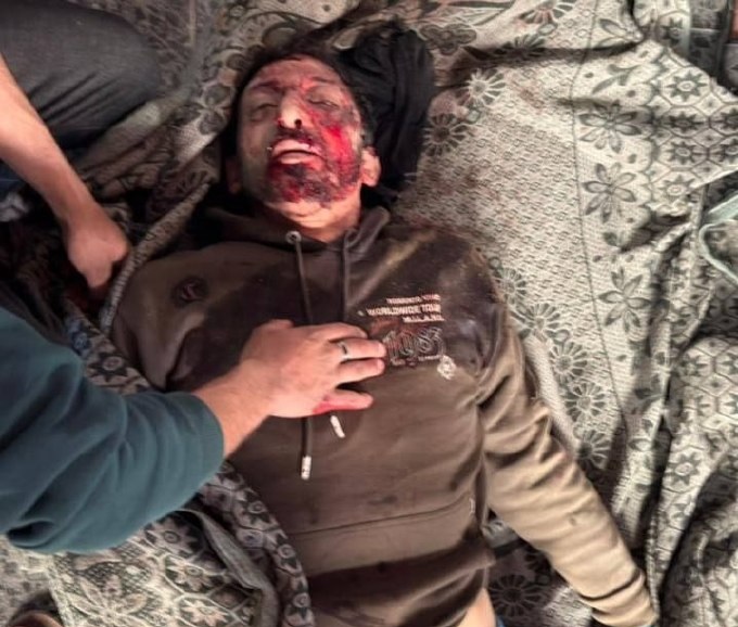 شهيدان شقيقان وإصابات بينها خطيرة برصاص الاحتلال بمدينة غزة