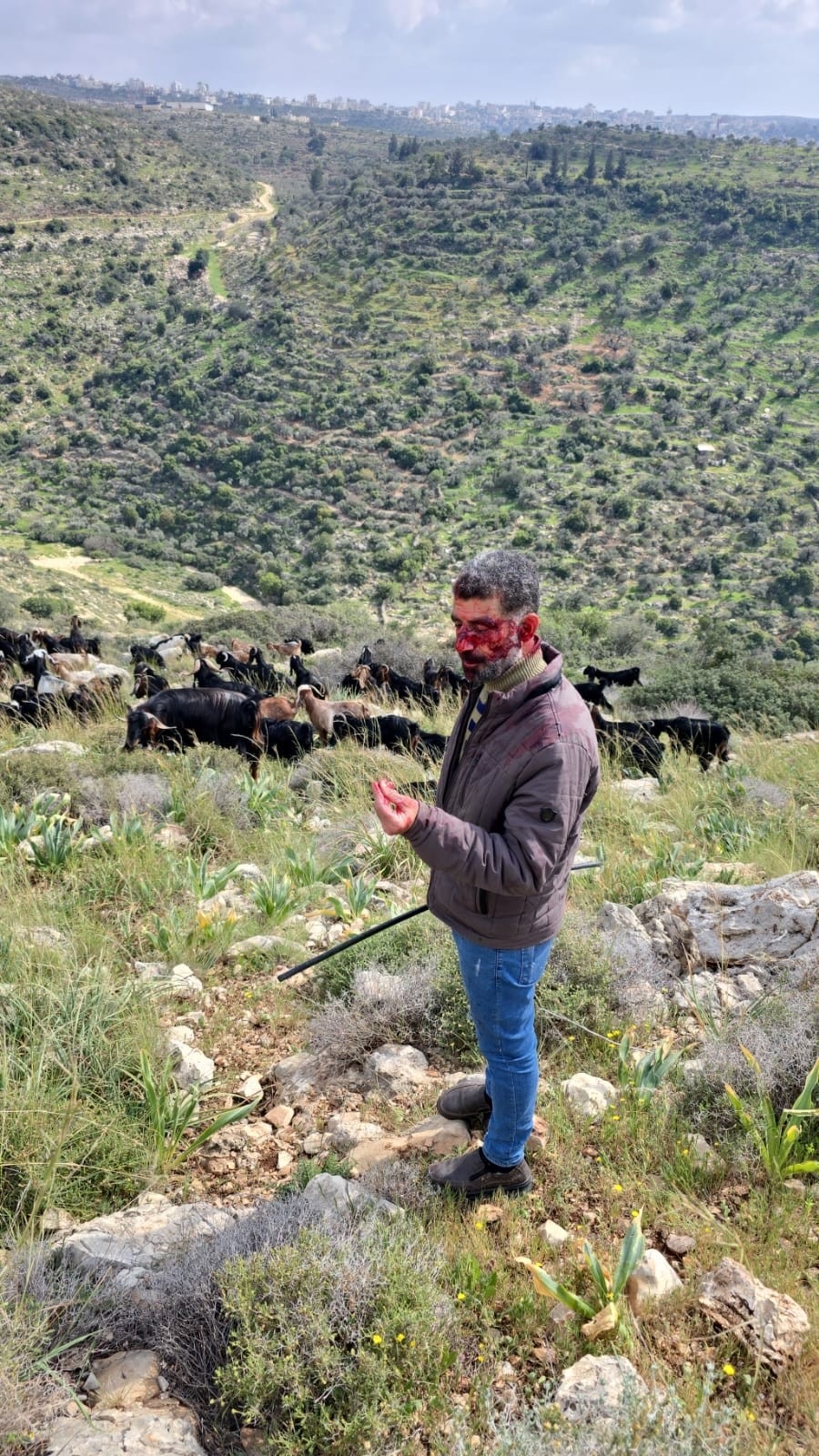 إصابة راعٍ باعتداء للمستوطنين غرب سلفيت