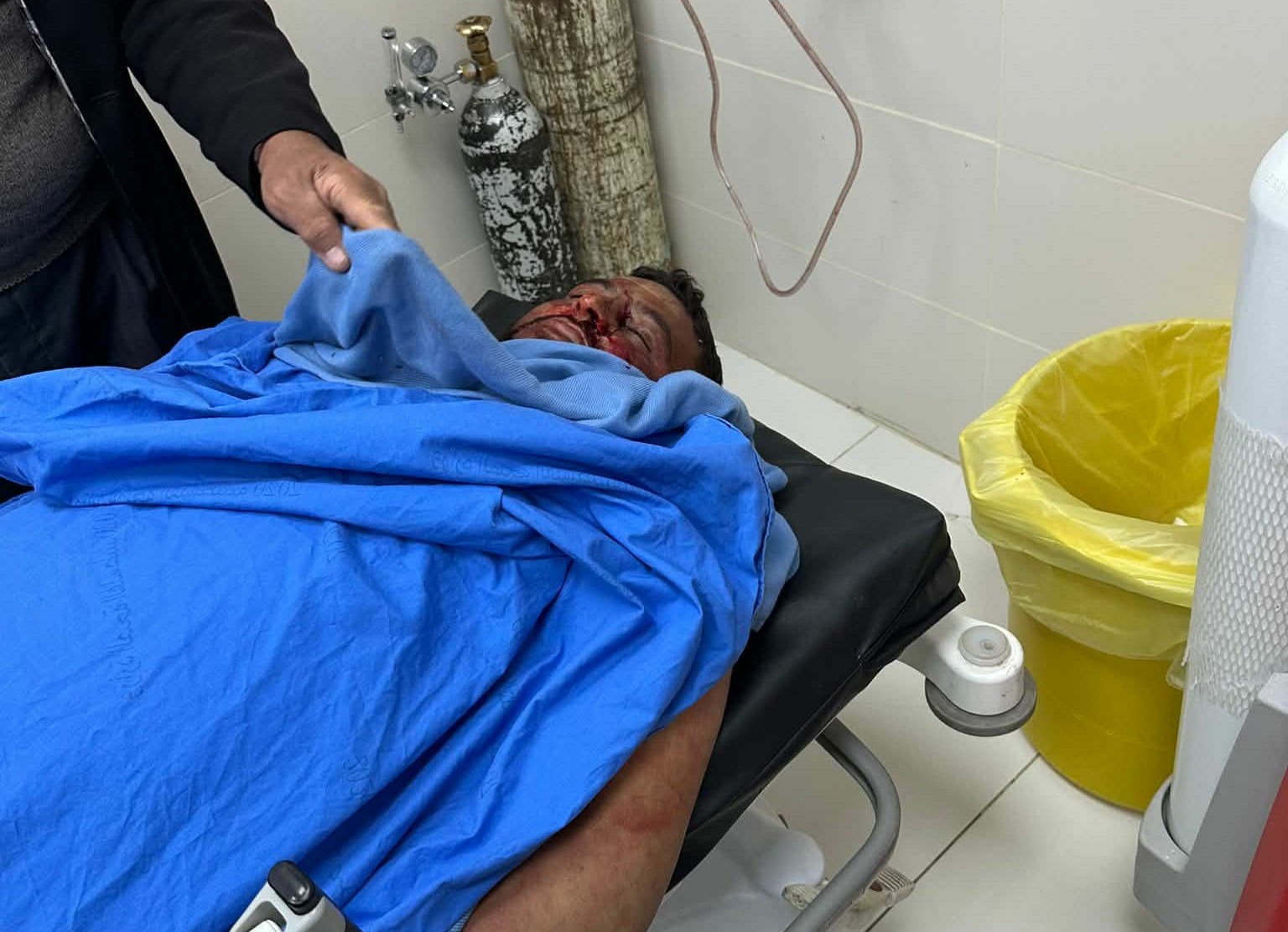 استشهاد الشاب أمير شناران وإصابة شقيقه برصاص مستوطنين بمسافر يطا جنوب الخليل