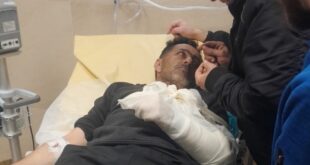 إصابتان باعتداء مستوطنين في جبع جنوب جنين