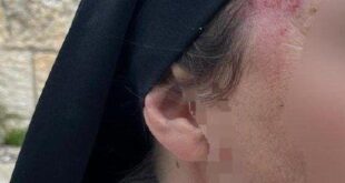 مستوطن يهاجم راهبة مسيحية في القدس ويصيبها بجروح