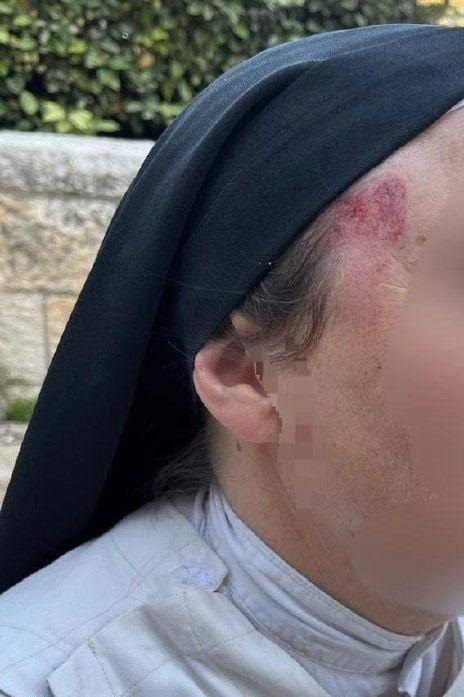 مستوطن يهاجم راهبة مسيحية في القدس ويصيبها بجروح