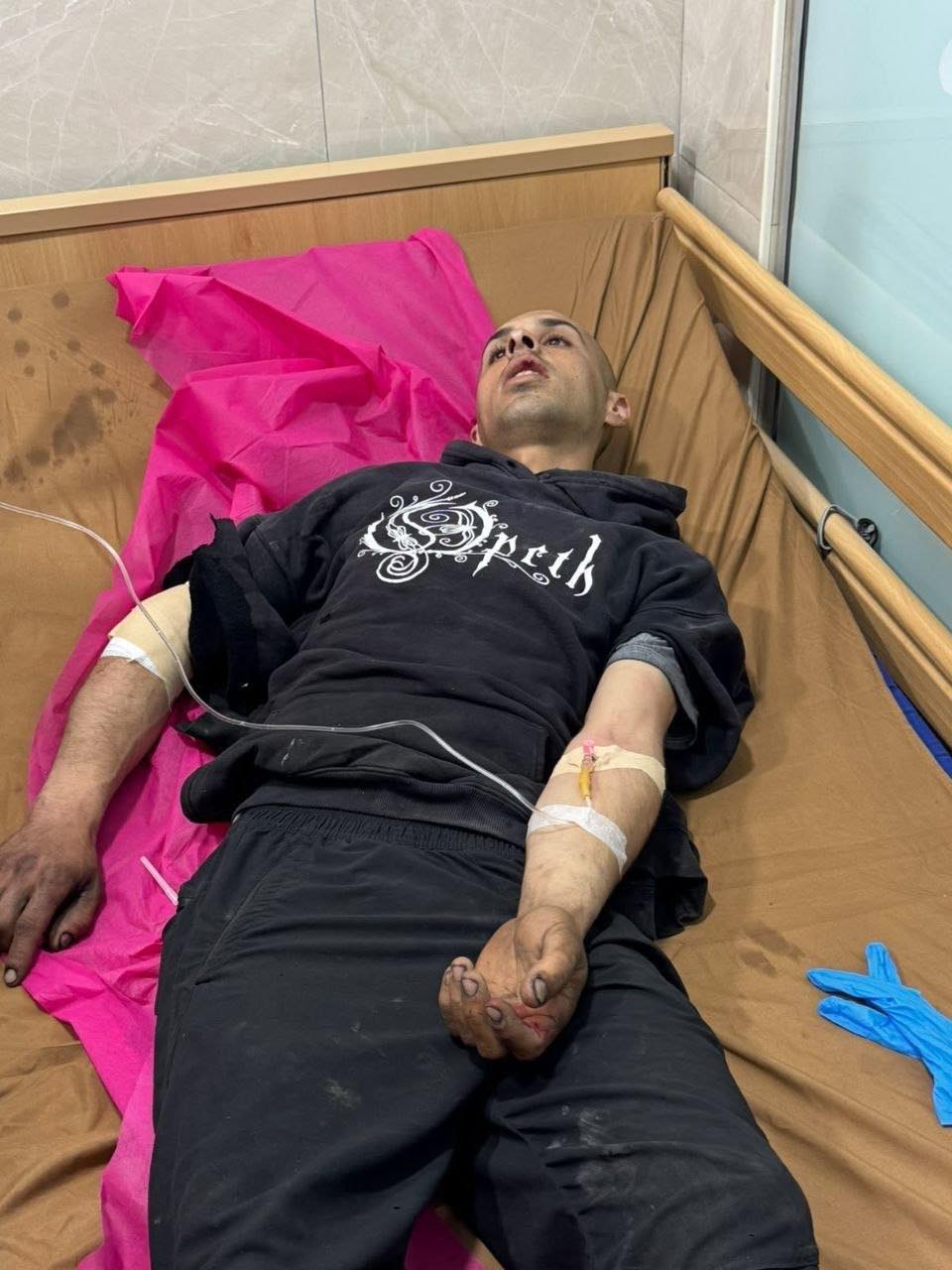 إصابة شاب بجروح عقب هجوم مستوطنين على منازل في قصرة جنوب نابلس