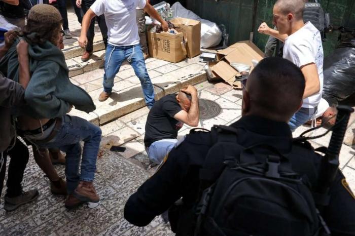 إصابة 3 مواطنين جراء اعتداء المستوطنين عليهم في جالود جنوب نابلس
