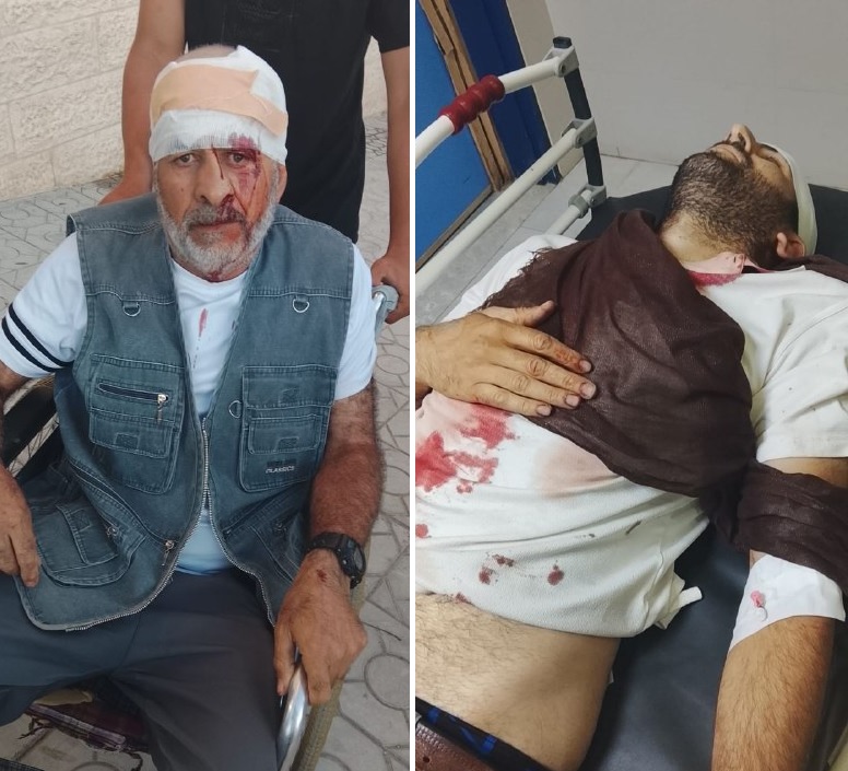 إصابة 3 مواطنين جراء هجوم للمستوطنين في يطا جنوب الخليل
