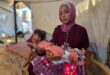 رئيس قسم الأطفال في مجمع ناصر الطبي: وفاة و10 آلاف إصابة بجدري المياه بين أطفال غزة