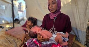 رئيس قسم الأطفال في مجمع ناصر الطبي: وفاة و10 آلاف إصابة بجدري المياه بين أطفال غزة