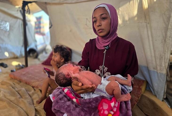 رئيس قسم الأطفال في مجمع ناصر الطبي: وفاة و10 آلاف إصابة بجدري المياه بين أطفال غزة