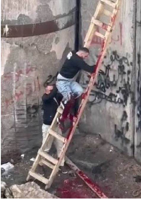 إصابة العامل أدهم أبو فضالة برصاص الاحتلال قرب جدار الفصل في بلدة الرام شمال القدس
