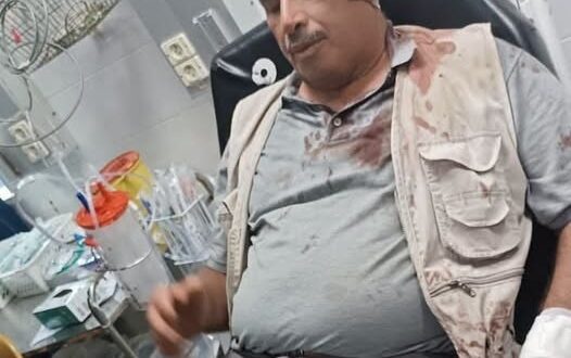 مستوطنون يعتدون بالضرب المبرح على مواطنين شرق سلفيت