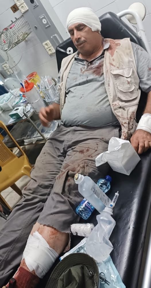 مستوطنون يعتدون بالضرب المبرح على مواطنين شرق سلفيت