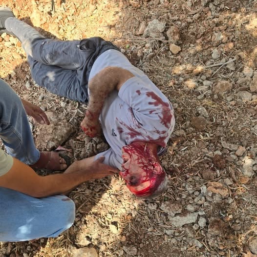 إصابة عدد من المواطنين إثر اعتداء وحشي للمستوطنين على بلدة أوصرين في نابلس